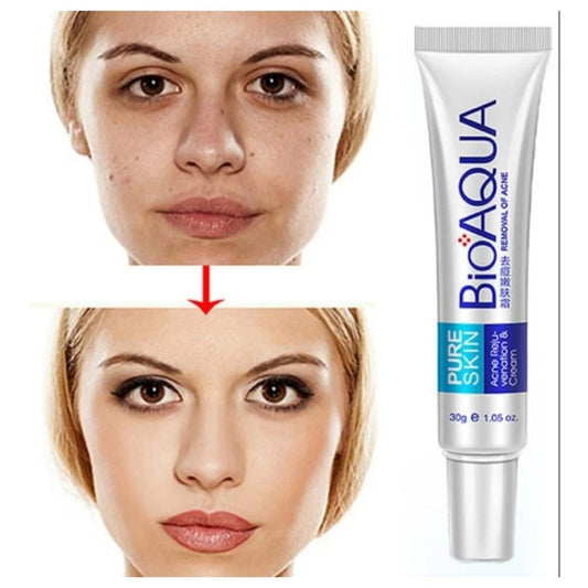 Bio Aqua Skin Acne Scar Removal Cream 30ml