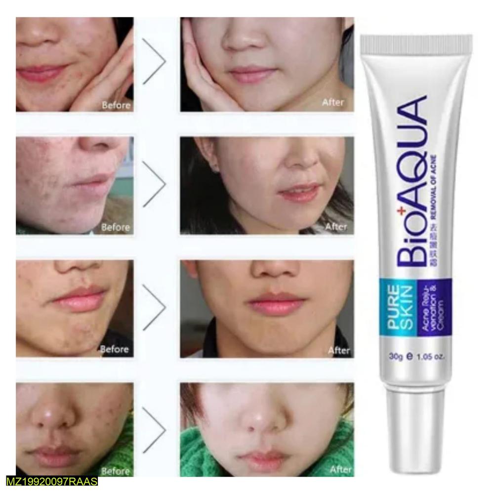 Bio Aqua Skin Acne Scar Removal Cream 30ml