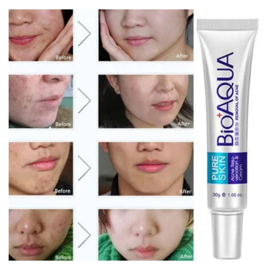 Bio Aqua Skin Acne Scar Removal Cream 30ml