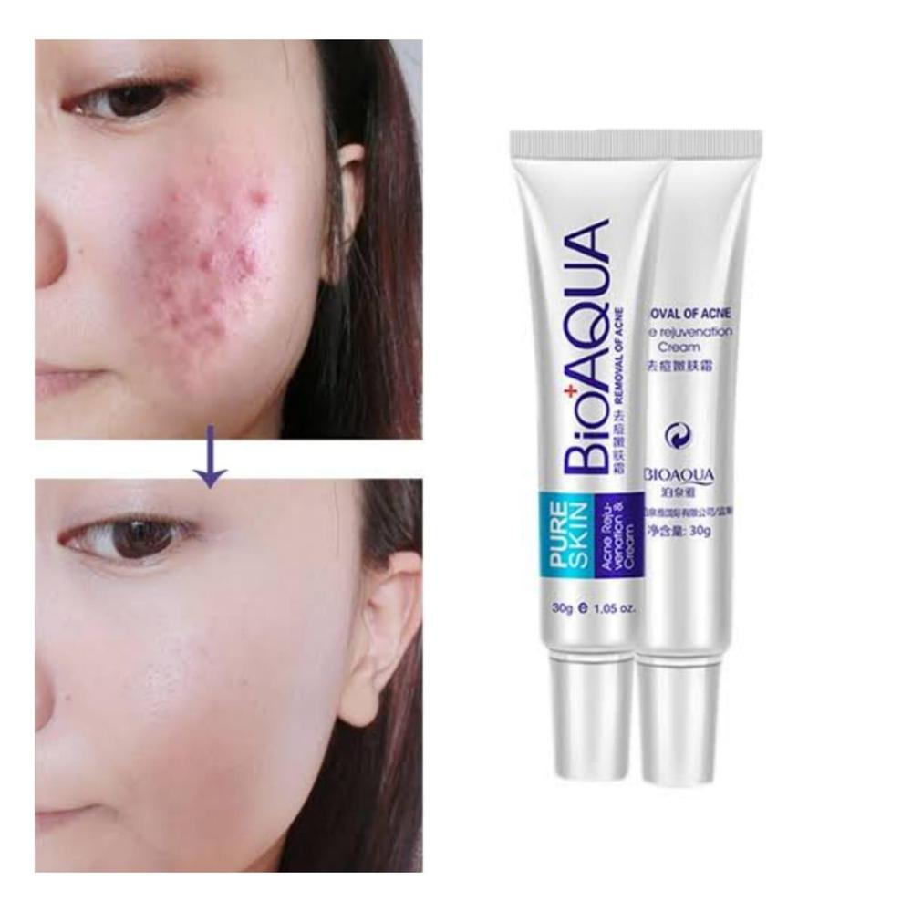Bio Aqua Skin Acne Scar Removal Cream 30ml